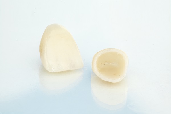 Common Dental Crown Solutions