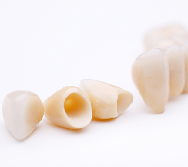 Levittown Dental Crowns and Dental Bridges