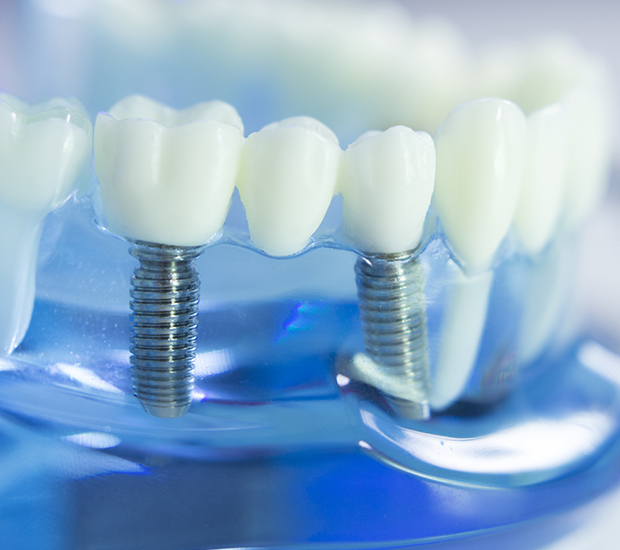 Levittown Dental Implants