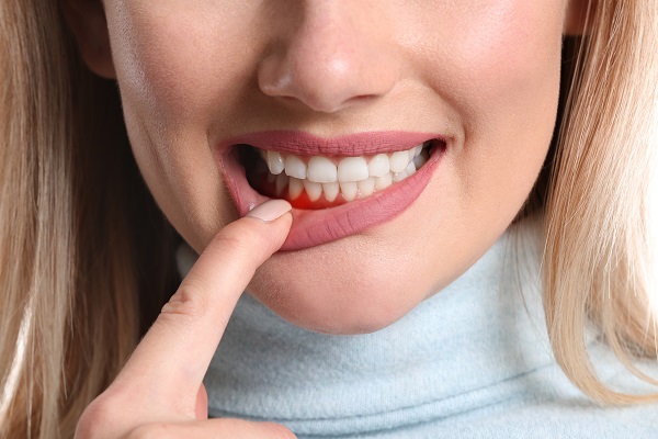 What Can Happen If My Gum Disease Is Left Untreated?