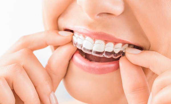 Preventing Yellow Teeth With Invisalign